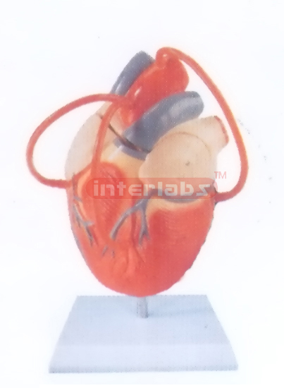 MIDDLE HEART MODEL WITH BYPASS